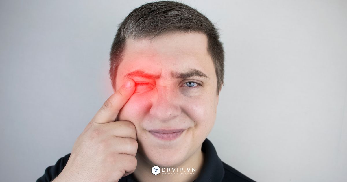 Bệnh lý về mắt