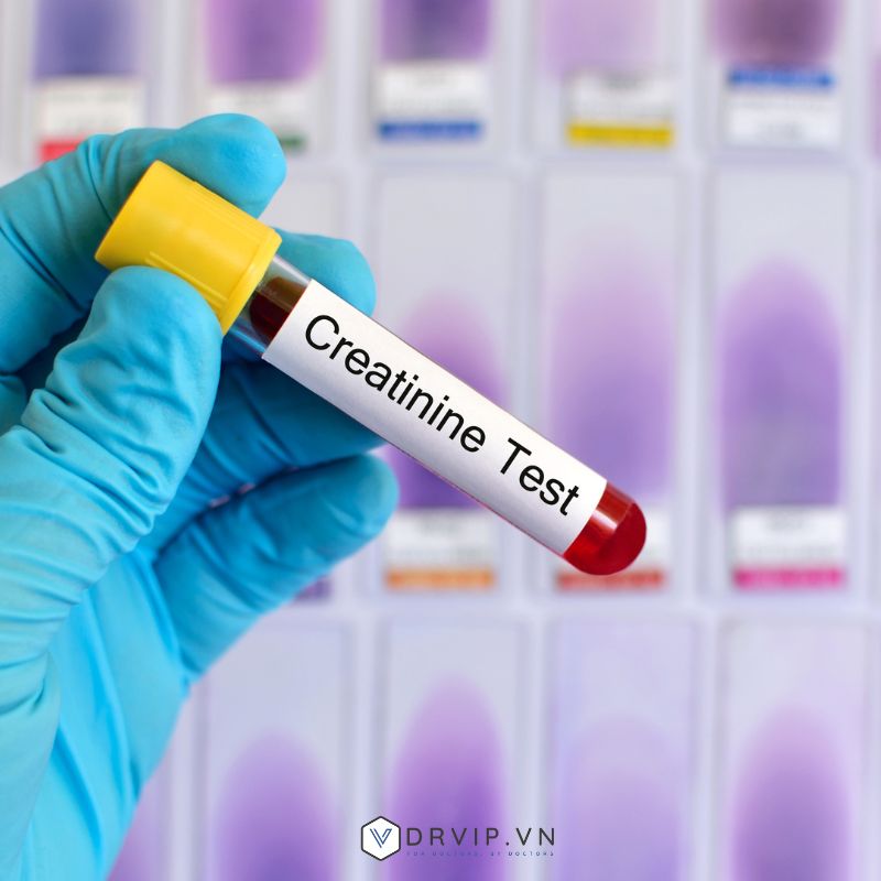 Creatinine