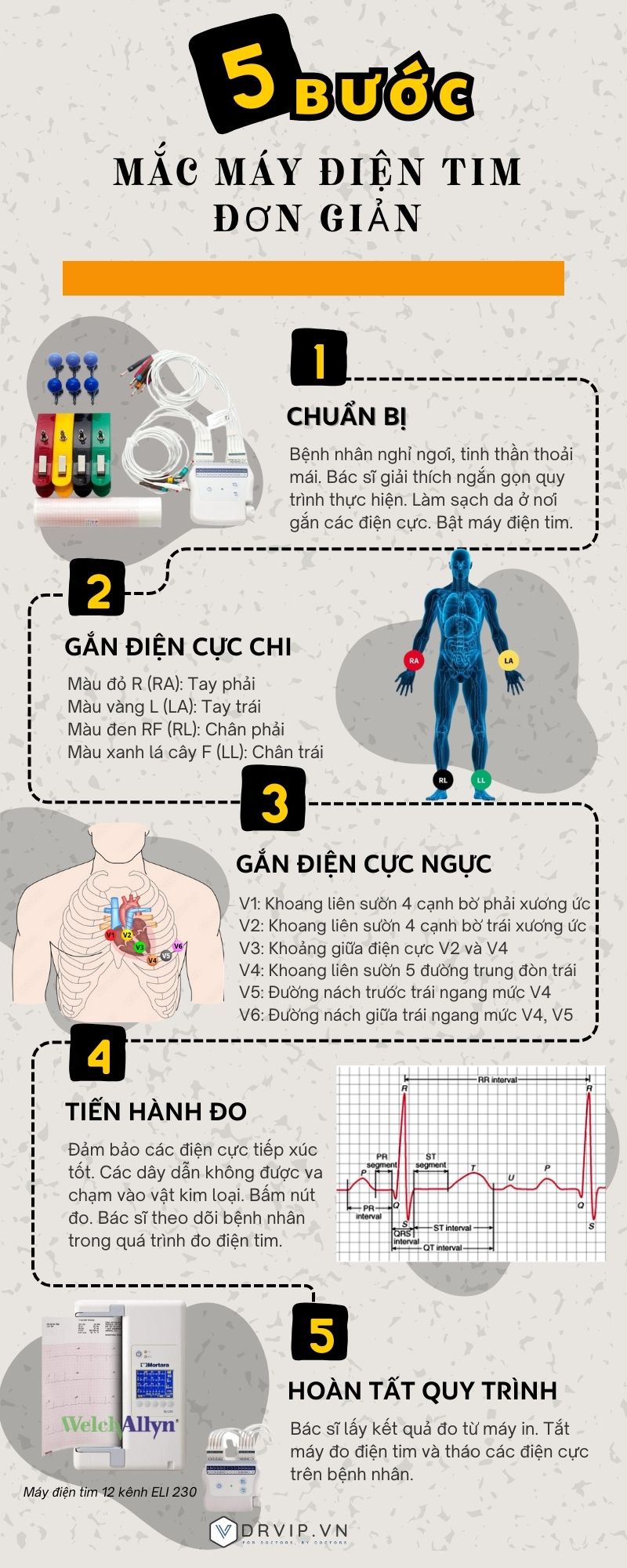 5 bước mắc máy điện tim đơn giản
