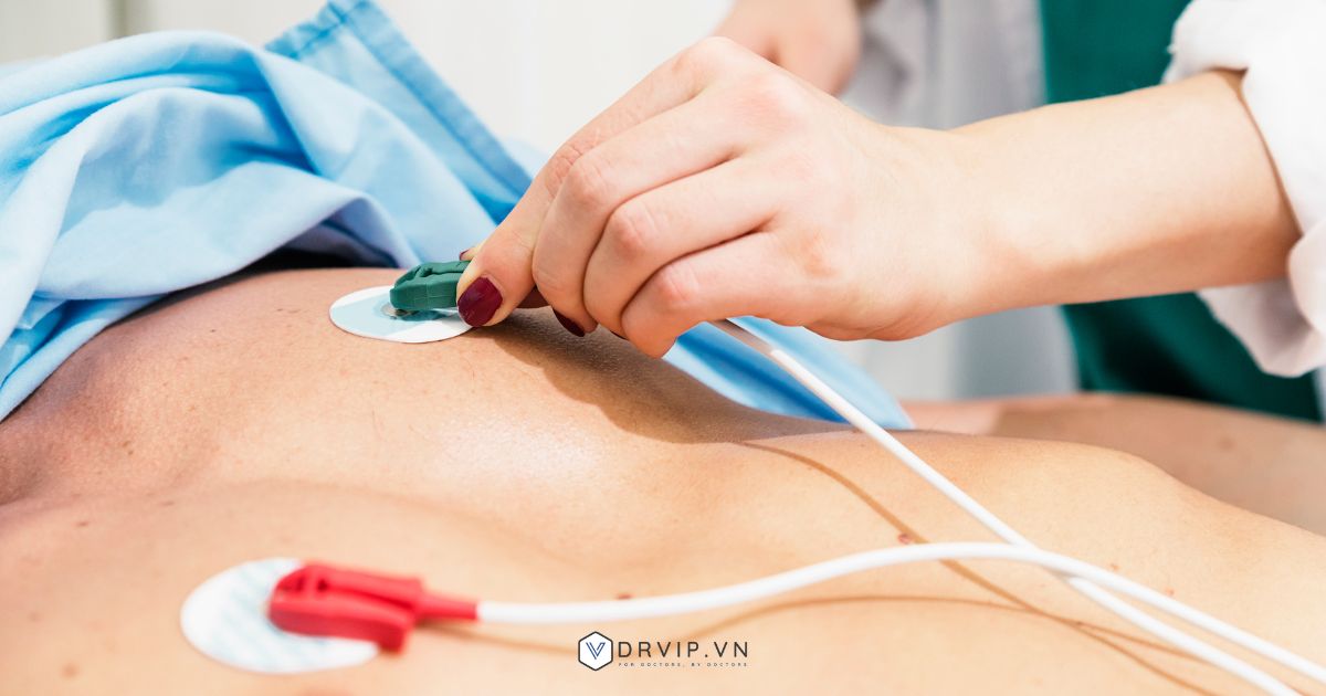 Đo ECG là gì