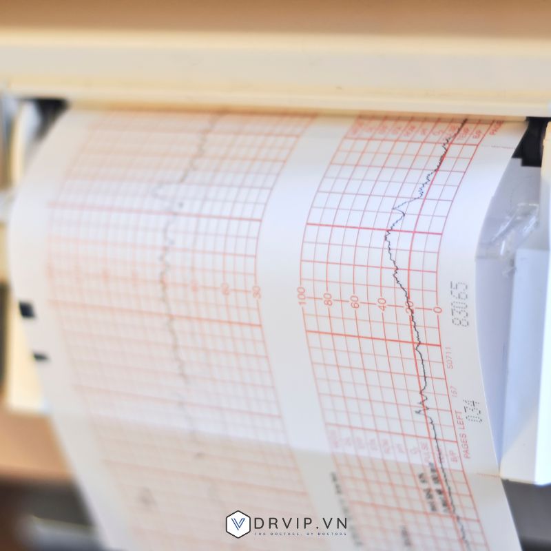 Phân máy đo ECG theo cách in giấy