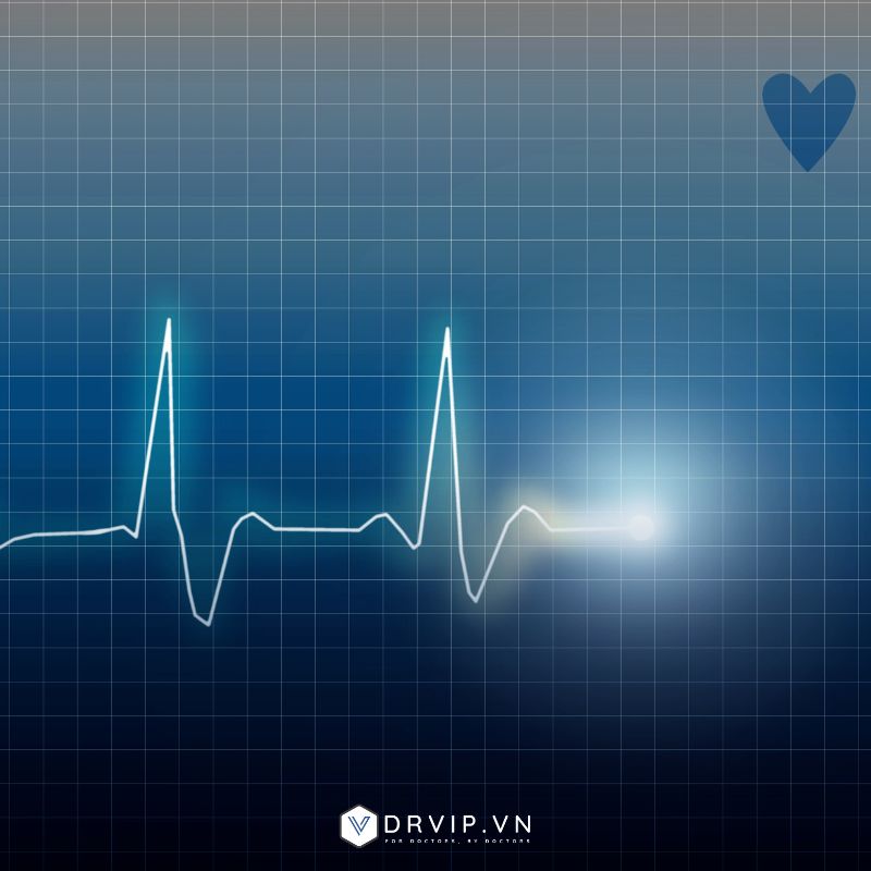 Điện tâm đồ (ECG)