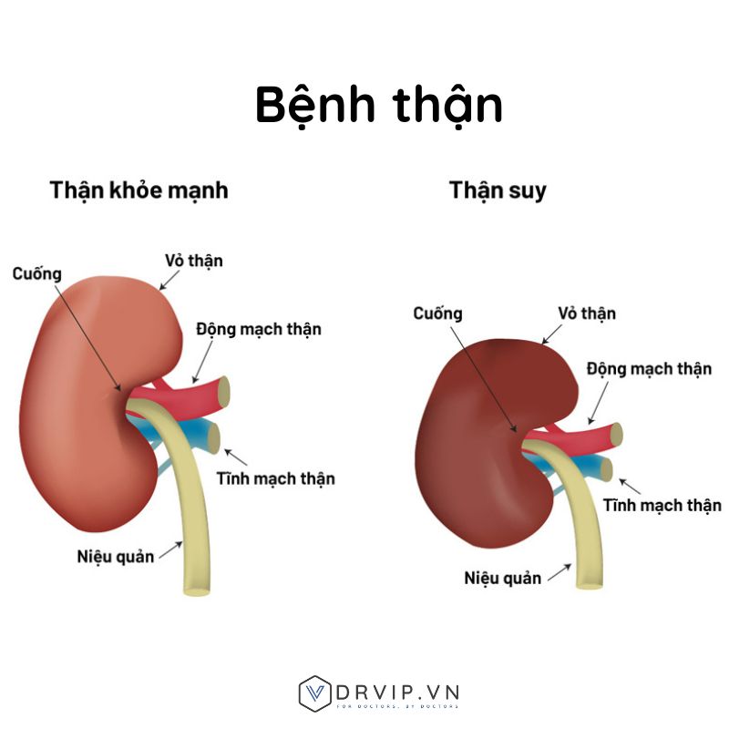 Benh-than