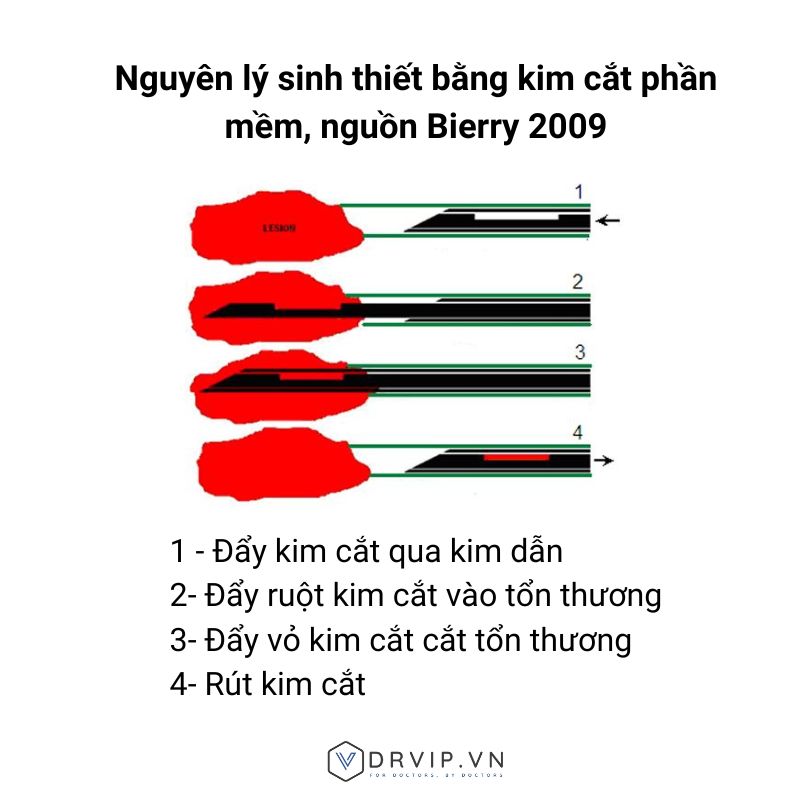 Kim-cat-phan-mem