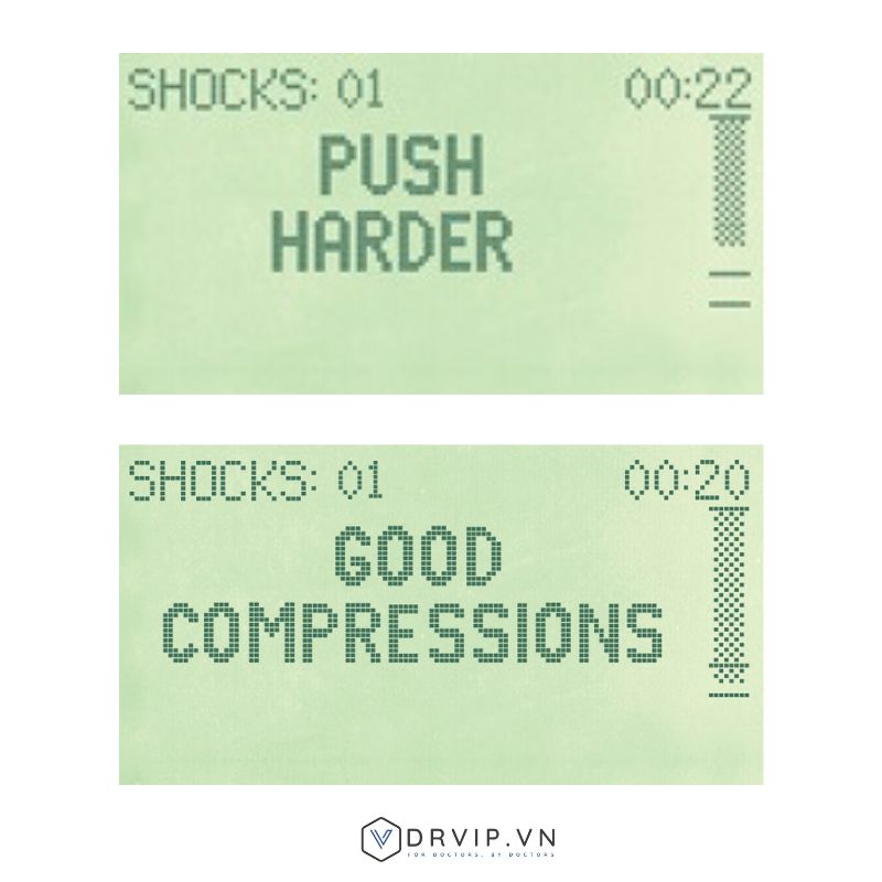 Shock-AED-Plus