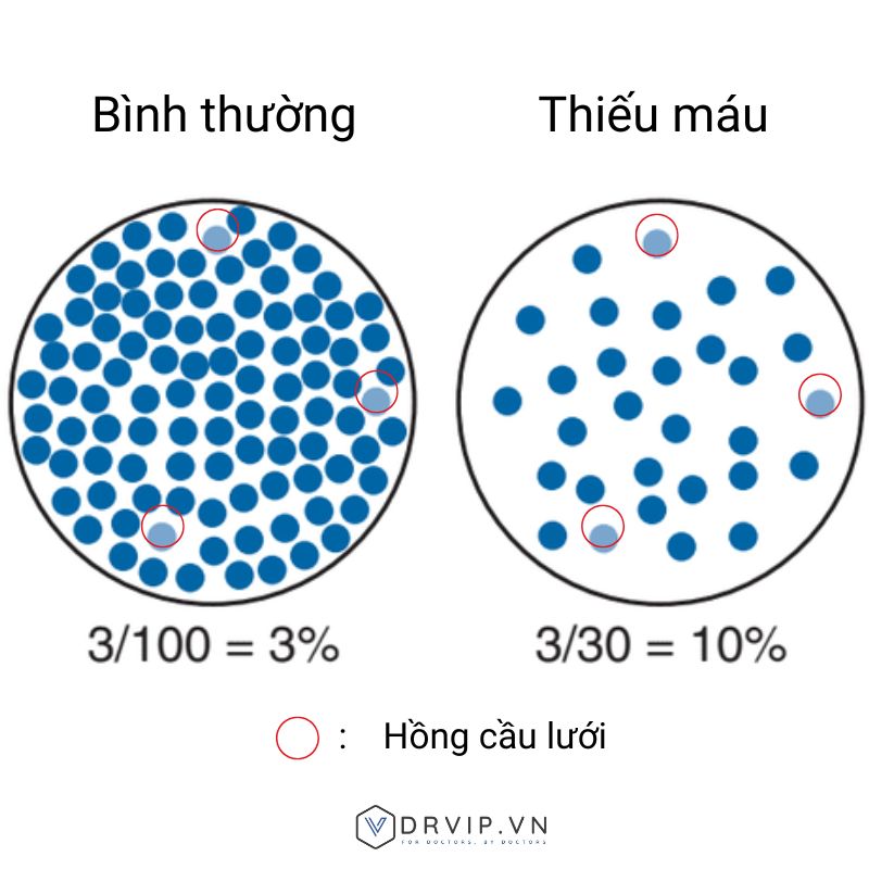Hong-cau-luoi