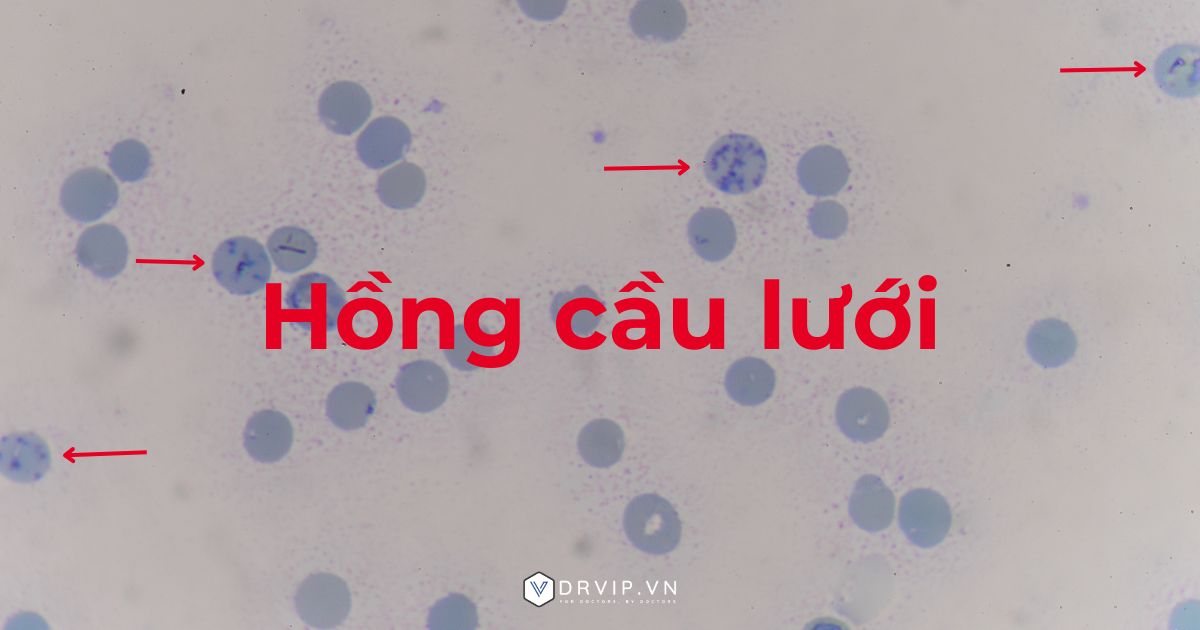 Hong-cau-luoi